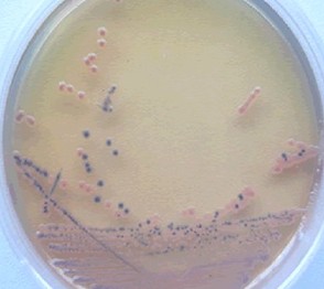 實驗室常用微生物菌種的分離和純化方法